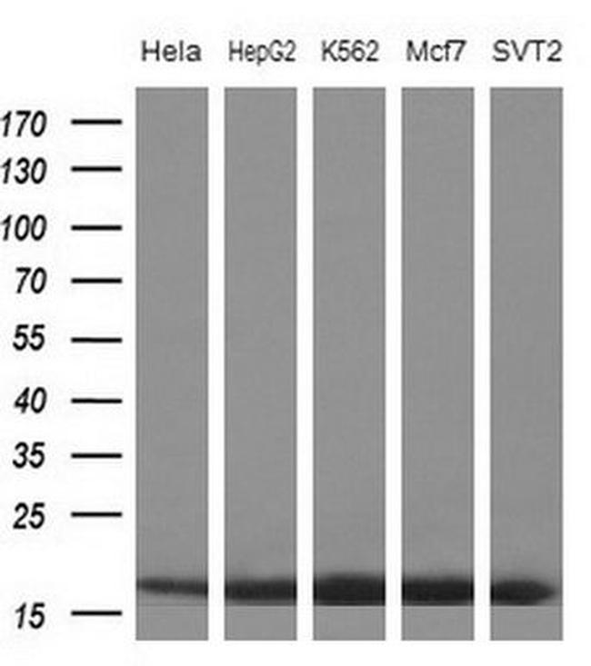 eIF1AY Antibody in Western Blot (WB)