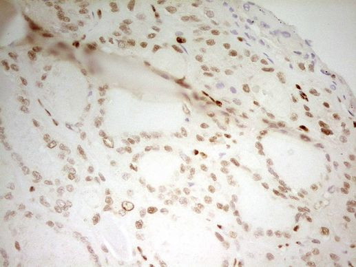 MEF2D Antibody in Immunohistochemistry (Paraffin) (IHC (P))