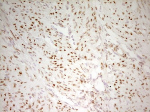 MEF2D Antibody in Immunohistochemistry (Paraffin) (IHC (P))