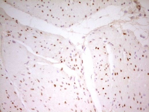 MEF2D Antibody in Immunohistochemistry (Paraffin) (IHC (P))