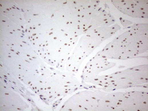 Pellino 1 Antibody in Immunohistochemistry (Paraffin) (IHC (P))