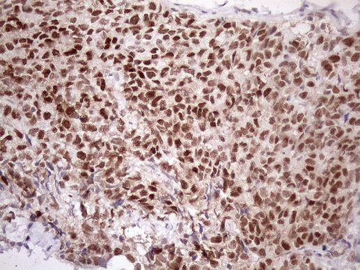 ATF1 Antibody in Immunohistochemistry (Paraffin) (IHC (P))