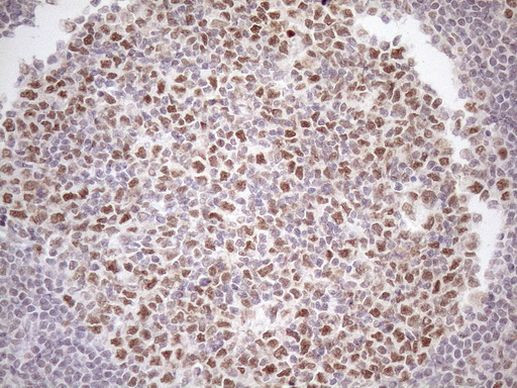 ATF1 Antibody in Immunohistochemistry (Paraffin) (IHC (P))