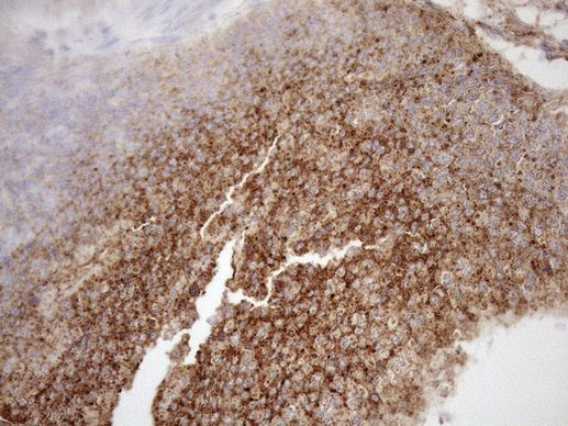 KCTD9 Antibody in Immunohistochemistry (Paraffin) (IHC (P))