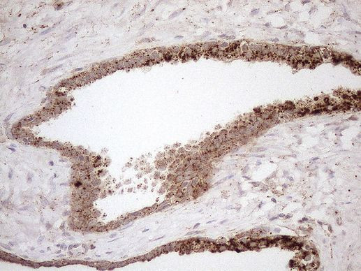 KCTD9 Antibody in Immunohistochemistry (Paraffin) (IHC (P))