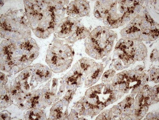 KCTD9 Antibody in Immunohistochemistry (Paraffin) (IHC (P))