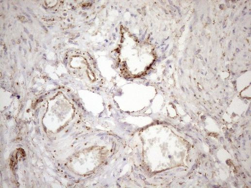 KCTD9 Antibody in Immunohistochemistry (Paraffin) (IHC (P))