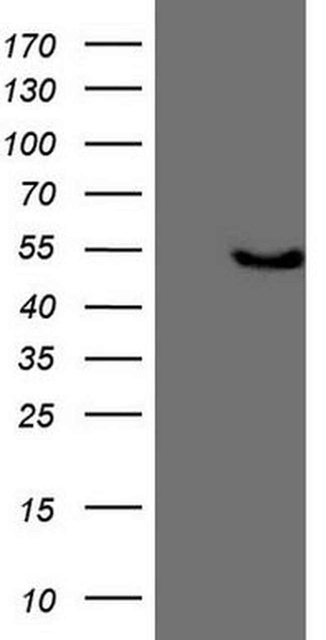 KCTD9 Antibody in Western Blot (WB)