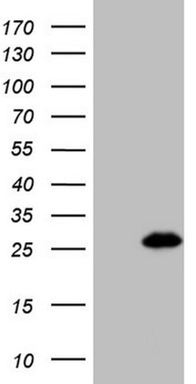 Bmf Antibody in Western Blot (WB)