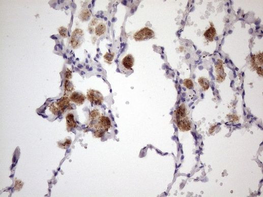 ALOX12 Antibody in Immunohistochemistry (Paraffin) (IHC (P))