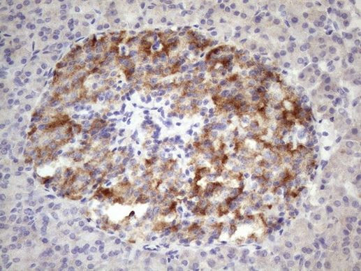 ALOX12 Antibody in Immunohistochemistry (Paraffin) (IHC (P))