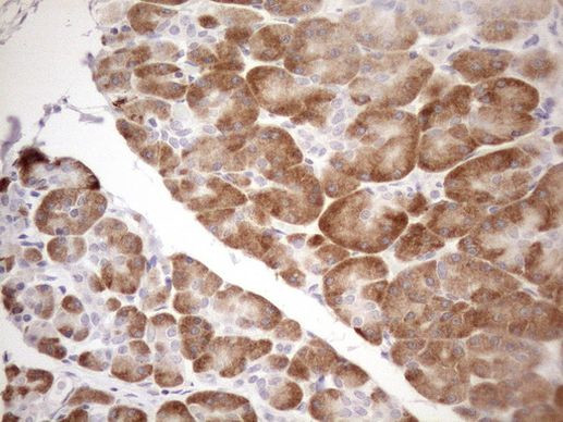 KCTD9 Antibody in Immunohistochemistry (Paraffin) (IHC (P))