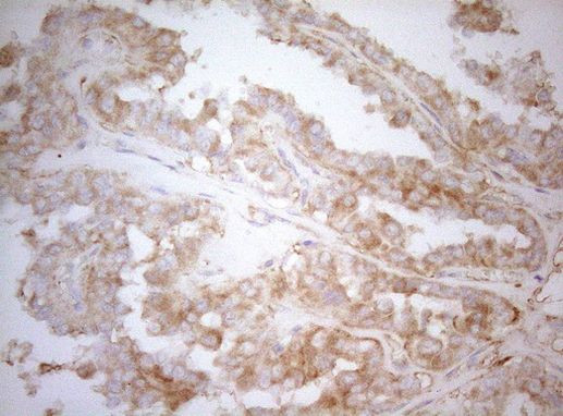 APPL1 Antibody in Immunohistochemistry (Paraffin) (IHC (P))