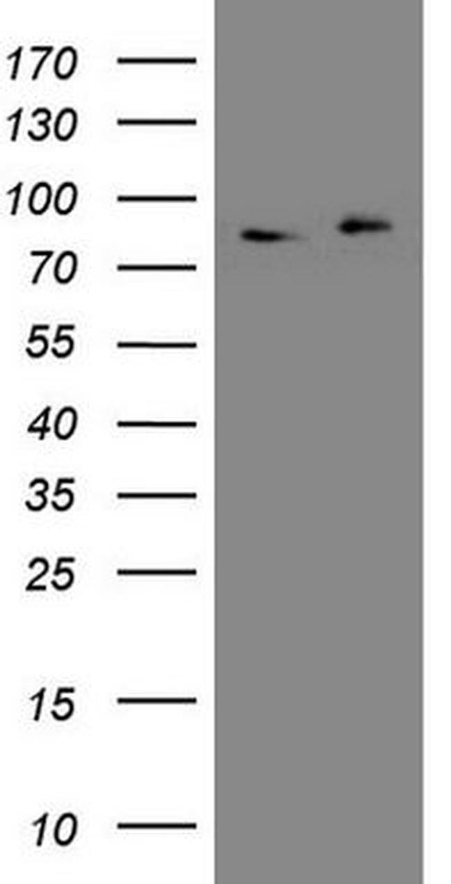 APPL1 Antibody in Western Blot (WB)