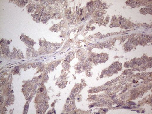 B4GALT4 Antibody in Immunohistochemistry (Paraffin) (IHC (P))