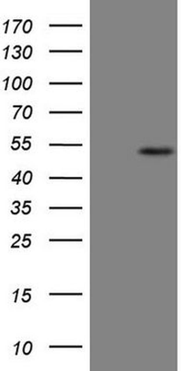 B4GALT4 Antibody in Western Blot (WB)