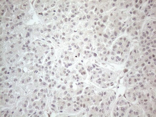 CtBP2 Antibody in Immunohistochemistry (Paraffin) (IHC (P))