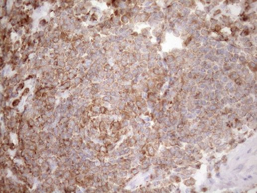 Kindlin 3 Antibody in Immunohistochemistry (Paraffin) (IHC (P))