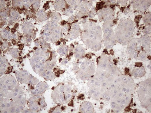 Kindlin 3 Antibody in Immunohistochemistry (Paraffin) (IHC (P))