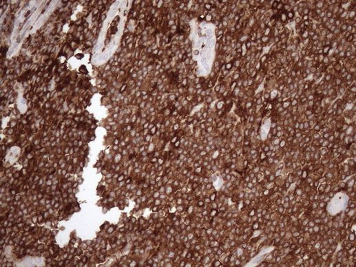 Kindlin 3 Antibody in Immunohistochemistry (Paraffin) (IHC (P))