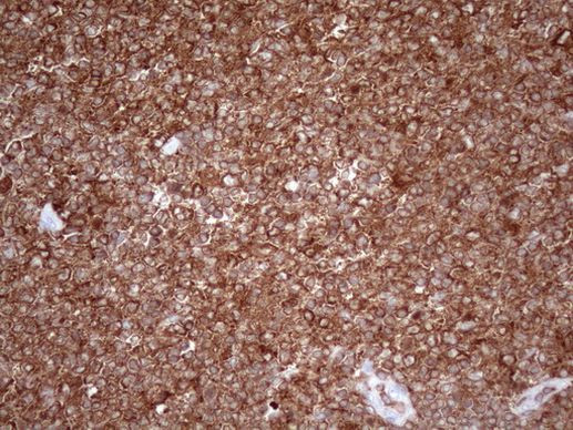 Kindlin 3 Antibody in Immunohistochemistry (Paraffin) (IHC (P))