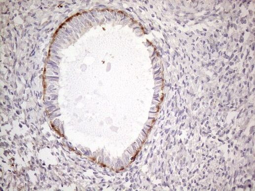 A26C2 Antibody in Immunohistochemistry (Paraffin) (IHC (P))