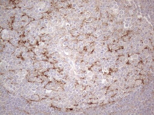 A26C2 Antibody in Immunohistochemistry (Paraffin) (IHC (P))