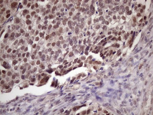 SPT3 Antibody in Immunohistochemistry (Paraffin) (IHC (P))