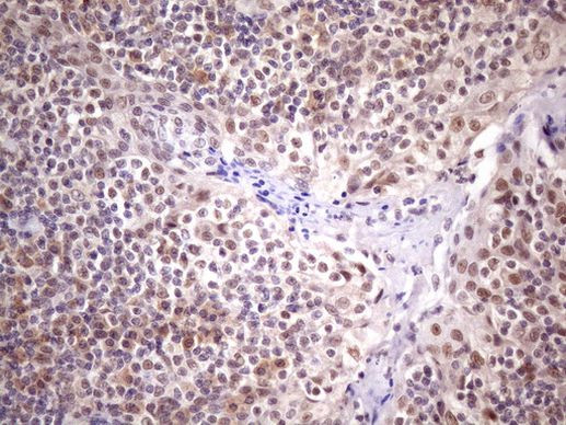 SPT3 Antibody in Immunohistochemistry (Paraffin) (IHC (P))