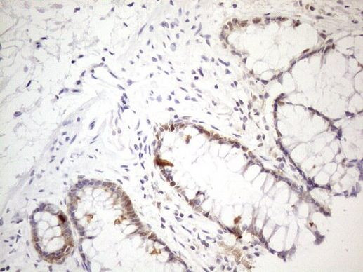 PSMG2 Antibody in Immunohistochemistry (Paraffin) (IHC (P))