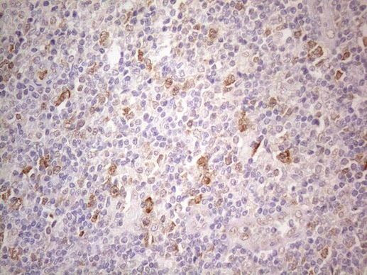 PSMG2 Antibody in Immunohistochemistry (Paraffin) (IHC (P))