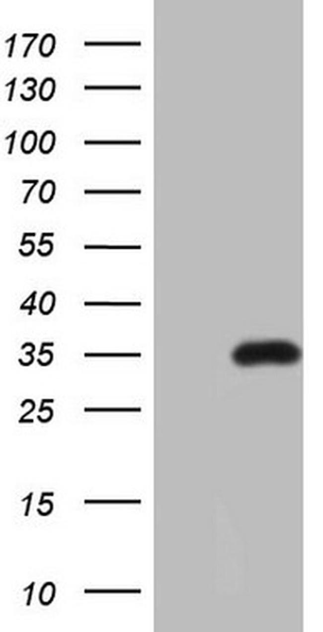 PSMG2 Antibody in Western Blot (WB)