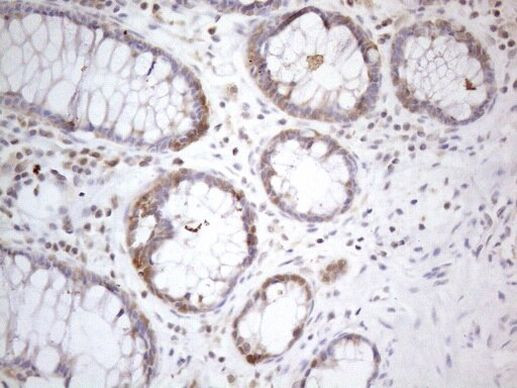 PSMG2 Antibody in Immunohistochemistry (Paraffin) (IHC (P))