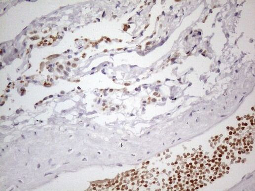 PSMG2 Antibody in Immunohistochemistry (Paraffin) (IHC (P))