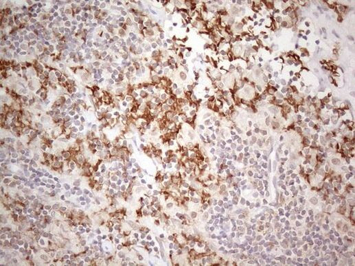 PSMG2 Antibody in Immunohistochemistry (Paraffin) (IHC (P))