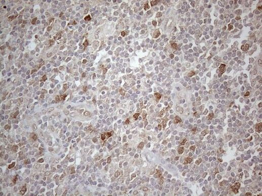 PSMG2 Antibody in Immunohistochemistry (Paraffin) (IHC (P))