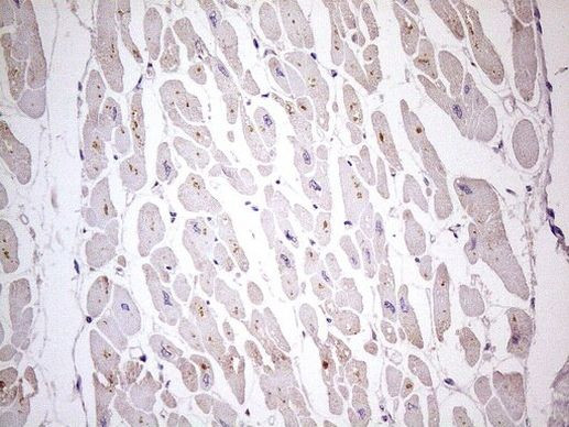 TBC1D28 Antibody in Immunohistochemistry (Paraffin) (IHC (P))