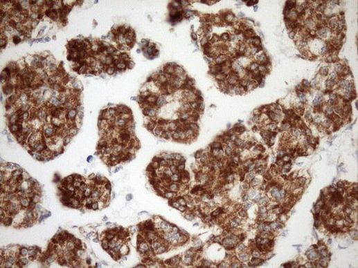 STOML2 Antibody in Immunohistochemistry (Paraffin) (IHC (P))