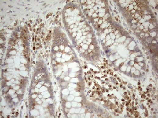 ZNF69 Antibody in Immunohistochemistry (Paraffin) (IHC (P))