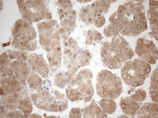 ZNF69 Antibody in Immunohistochemistry (Paraffin) (IHC (P))