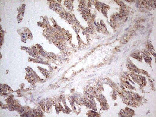 ZNF69 Antibody in Immunohistochemistry (Paraffin) (IHC (P))