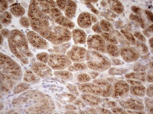 ZNF69 Antibody in Immunohistochemistry (Paraffin) (IHC (P))