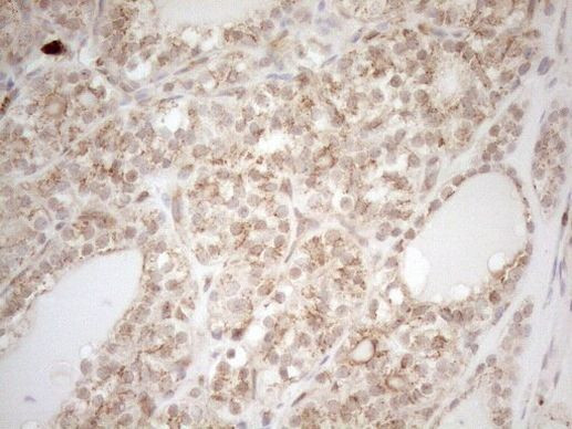 ZNF69 Antibody in Immunohistochemistry (Paraffin) (IHC (P))