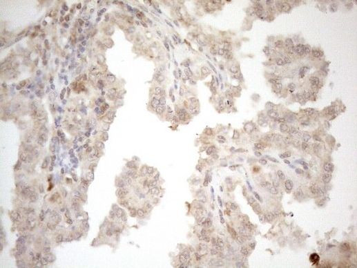 ZNF69 Antibody in Immunohistochemistry (Paraffin) (IHC (P))