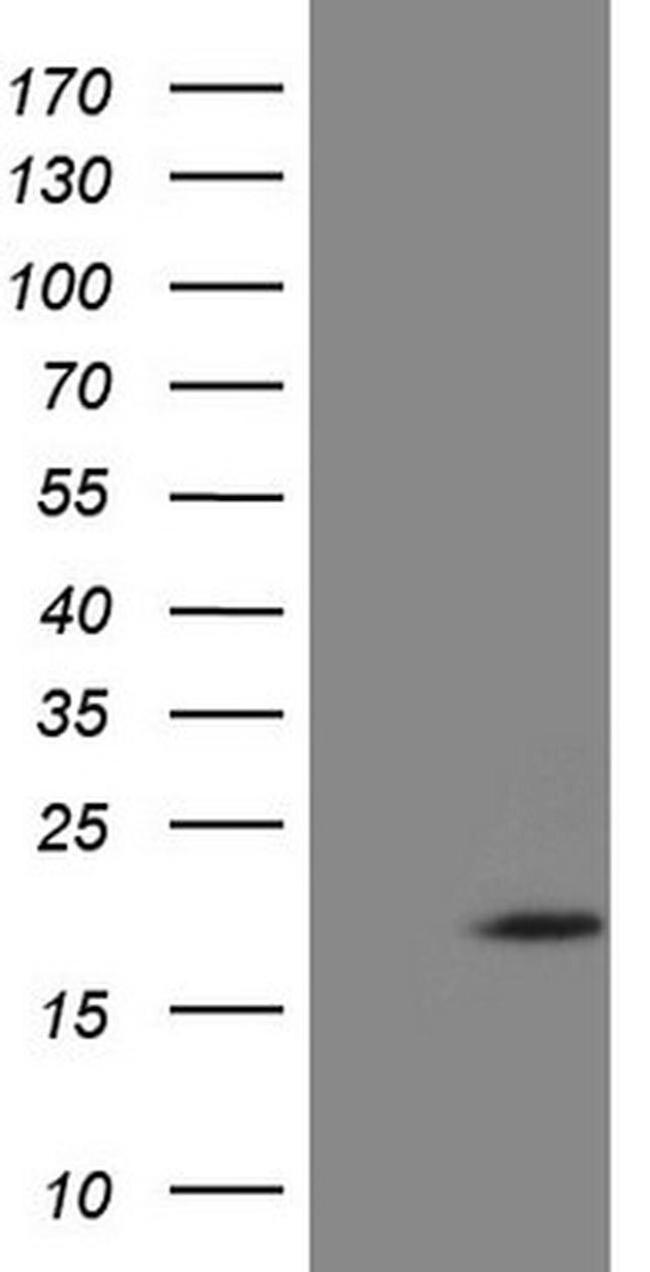 ZNF69 Antibody in Western Blot (WB)