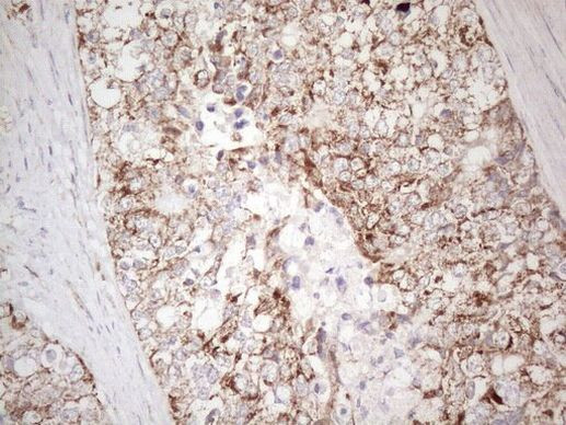 MAVS Antibody in Immunohistochemistry (Paraffin) (IHC (P))