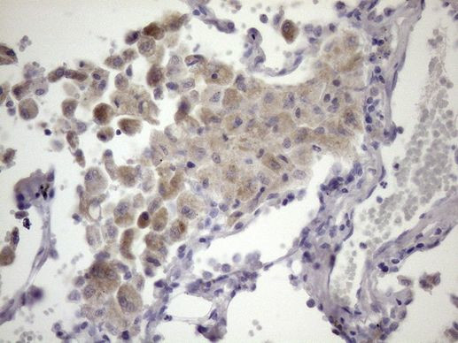 ATP6V1C2 Antibody in Immunohistochemistry (Paraffin) (IHC (P))