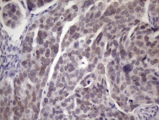 ATP6V1C2 Antibody in Immunohistochemistry (Paraffin) (IHC (P))