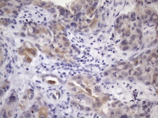 ATP6V1C2 Antibody in Immunohistochemistry (Paraffin) (IHC (P))