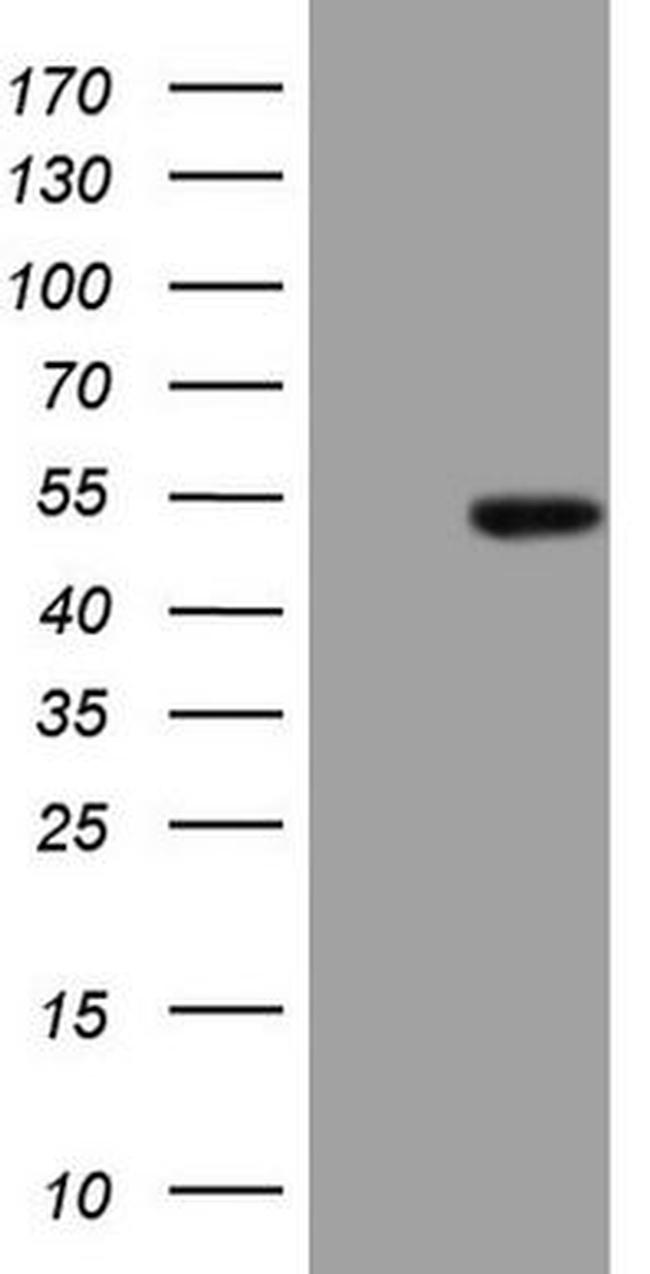 ATP6V1C2 Antibody in Western Blot (WB)